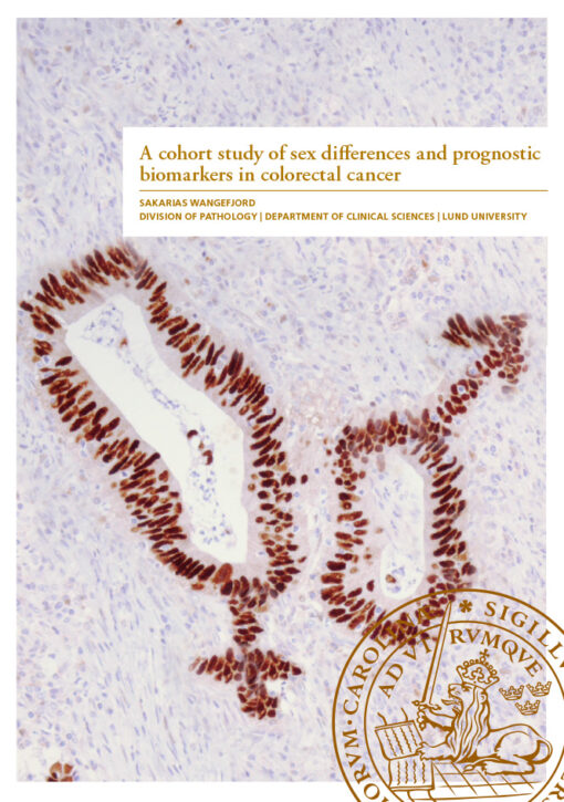A cohort study of sex differences and prognostic biomarkers in colorectal cancer
